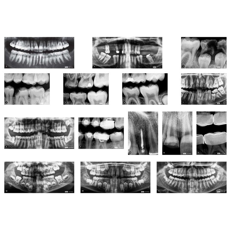ROYLCO - Dental X-Rays