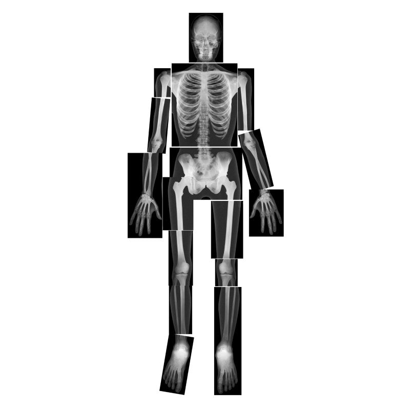 ROYLCO - True to Life Human X-Ray Set, Pack of 18